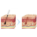 Alvi Prague Elektroepilation-Gerät Epil Ultimate N-01