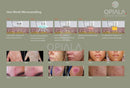 Opiala MicroPRO3 Fractional RF x microneedling x Coldhammer 3 in 1